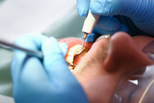 Best Dental Abscess Treatment in Coleman, MI