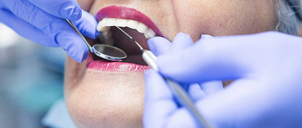 Best Broken or Chipped Tooth Repair in Coleman, MI